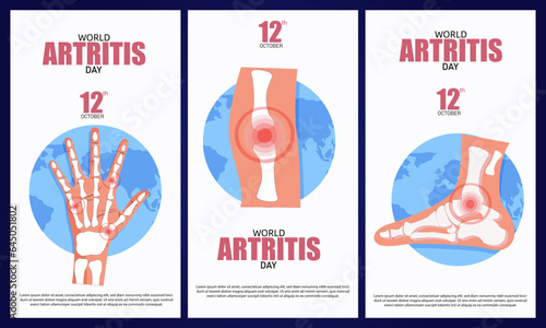 World Arthritis Day is a global awareness event dedicated to raising understanding about arthritis
