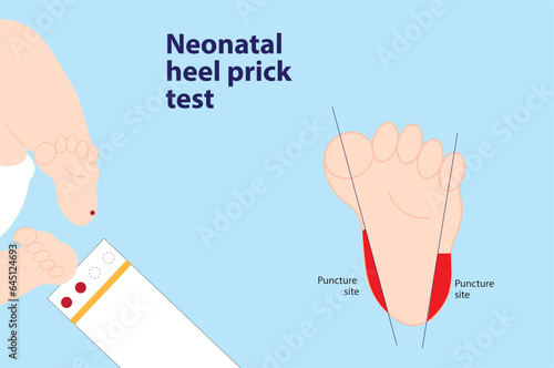 Neonatal heel prick test illustration. Newborn foot with blood and the test paper And foot illustration with the correct puncture site photo
