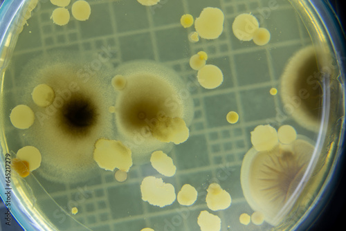 Backgrounds of Characteristics  of Bacteria and Fungi  for education in Microbiology laboratory. photo