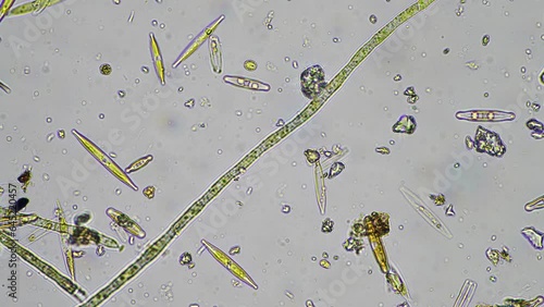 diatom and water microorganisms under the microscope photo