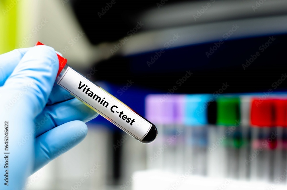 Blood sampling tube for vitamin C analysis. Blood sampling tube for vitamin C analysis.