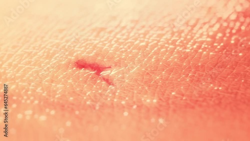 Skin Scar Regeneration. 3D Render - The wound with blood heals and completely disappears, leaving only a healthy skin texture.