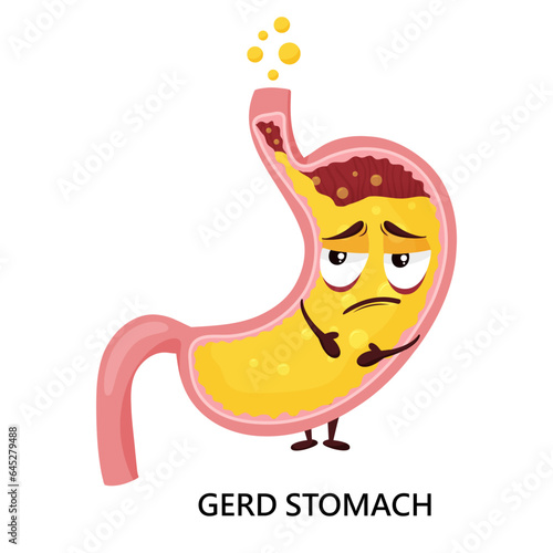 Gastroesophageal reflux disease and heartburn illustration with stomach cartoon character