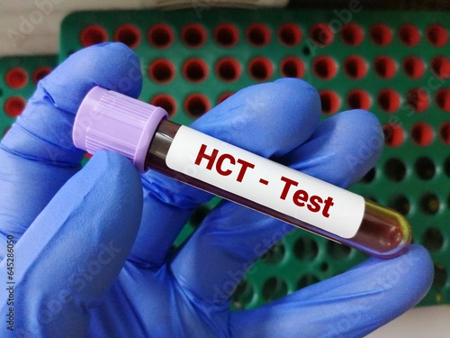 Blood sample for hematocrit (HCT) or Pack cell volume (PCV) test.