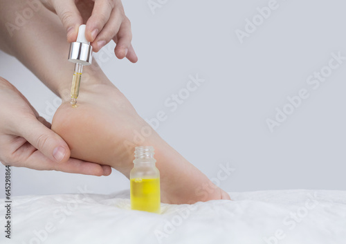 Cracked heels. Woman feet before and after procedures to soften rough skin. Urea cream, oil for care of keratinized skin, healing of cracked foot. Usage foot grater, cream with urea, softening oil. photo