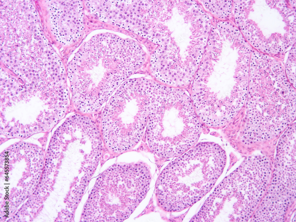 histology human tissue with microscope from laboratory (not Illustration Designation) histology human tissue with microscope from laboratory (not Illustration Designation)