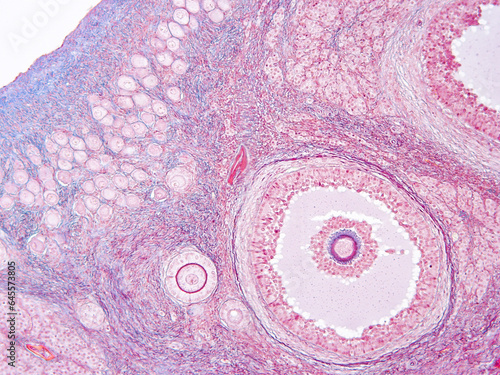 histology human tissue with microscope from laboratory (not Illustration Designation) photo