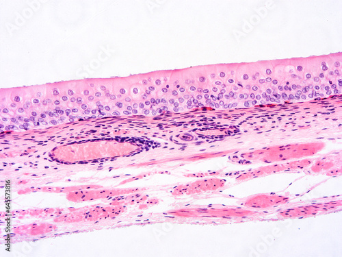 histology human tissue with microscope from laboratory (not Illustration Designation)