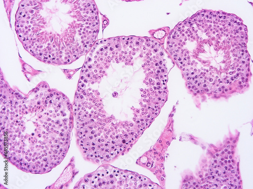 histology human tissue with microscope from laboratory  not Illustration Designation 