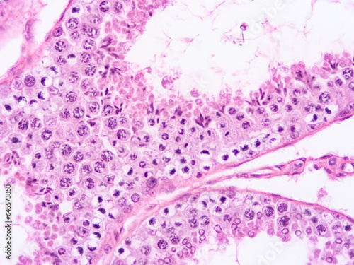 histology human tissue with microscope from laboratory (not Illustration Designation)