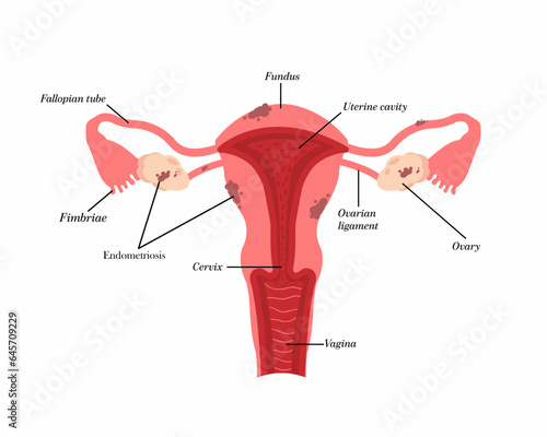 Uterus anatomy endometriosis The structure of the pelvic organs. Gynecology. photo