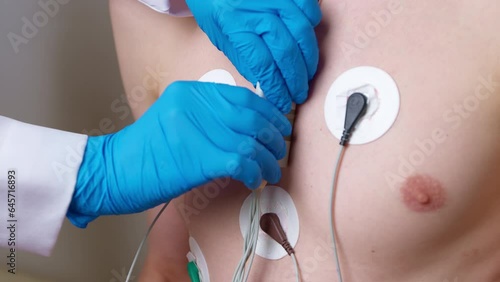 The doctor uses a Holter device to monitor the patient's heart electrocardiogram on a daily basis. photo