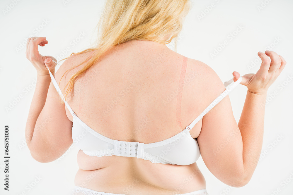 Overweight woman with fat back rubbed her shoulders with bra straps, obesity female body on white background - obrazy, fototapety, plakaty 
