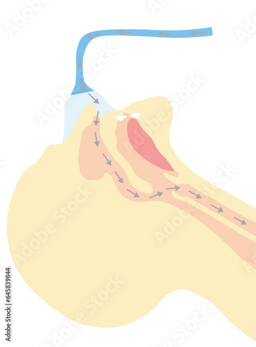 Cpap mask oxygen delivery thru the nose. Illustration of cpap mask