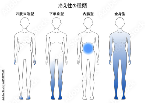 冷え性の種類