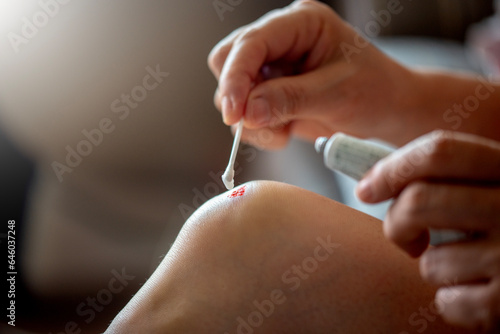 Applying ointment to the injured knee.