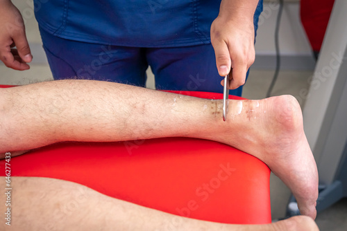 Instrumental mobilization of soft tissues, heel and arch pain treatment. photo