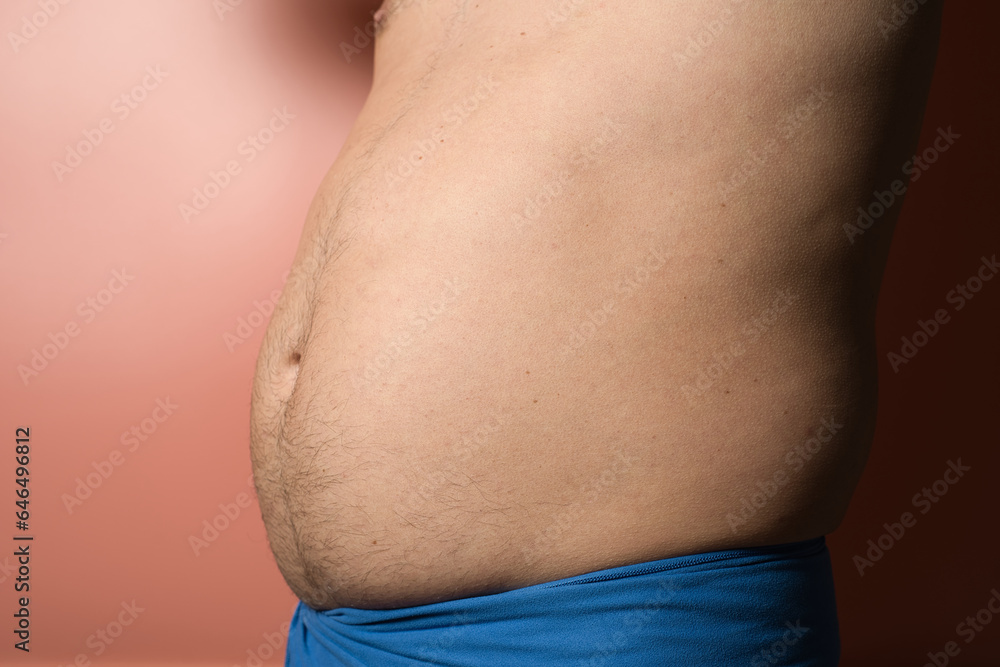 Close up of fat man's belly. Perhaps the concept of abdominal pain, bloating. Health concept. Close up of fat man's belly. Perhaps the concept of abdominal pain, bloating. Health concept.