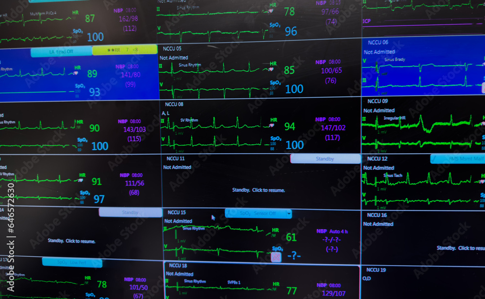 Hospital monitor displays vital signs: heart rate, blood pressure, EKG, and oxygen levels, symbolizing patient health Hospital monitor displays vital signs: heart rate, blood pressure, EKG, and oxygen levels, symbolizing patient health