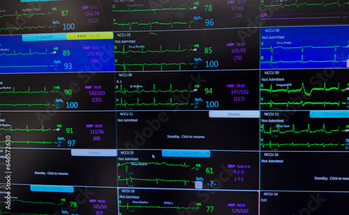 Hospital monitor displays vital signs: heart rate, blood pressure, EKG, and oxygen levels, symbolizing patient health