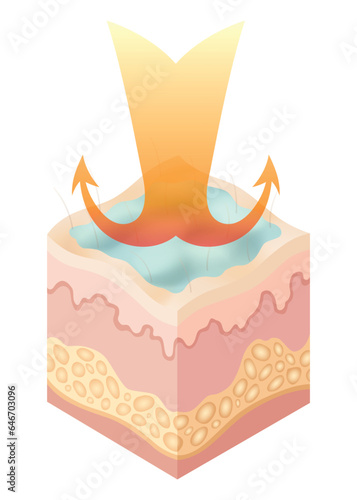 Protection uv ray skin. Illustration about Skin care concept. Sun protection body adipose layers epidermis, vector infographic