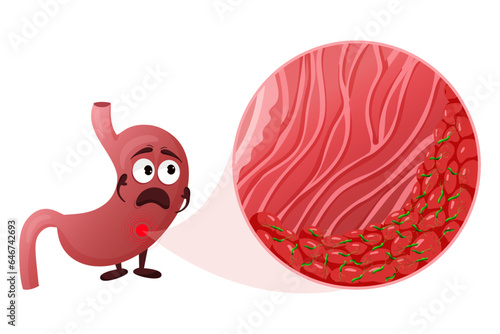 Cartoon stomach character with helicobacter pylori infection in mucosa layer under magnification
