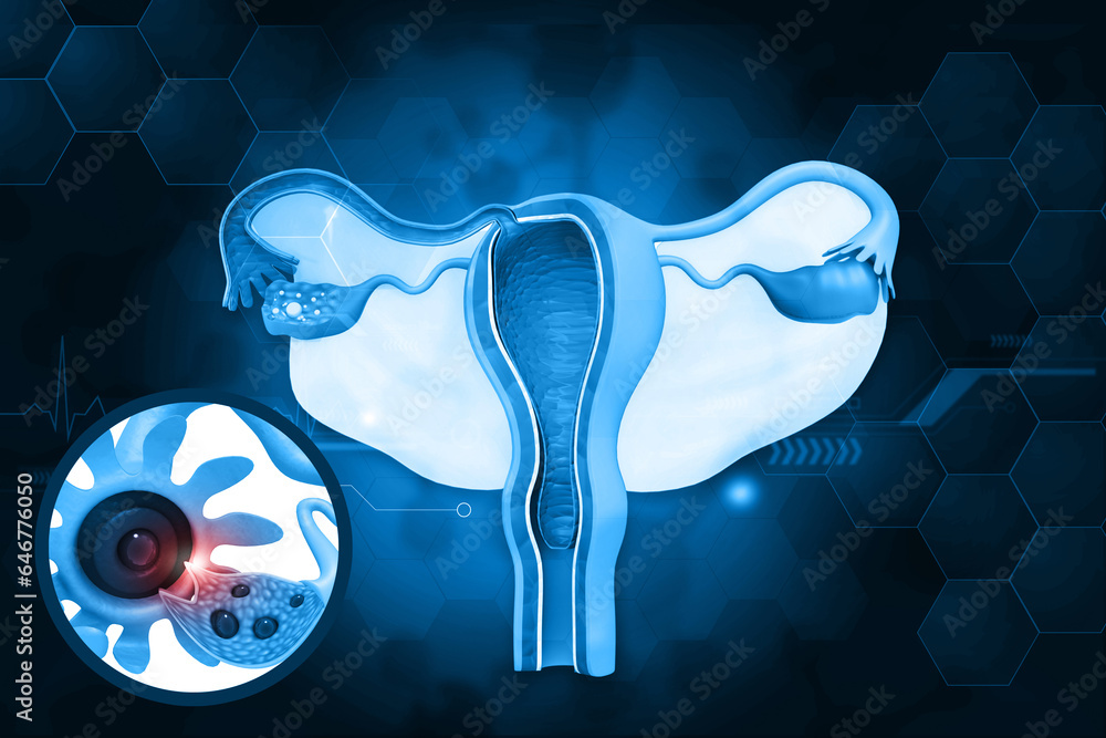 UTERUS HUMAN ANATOMY IMAGE FUNCTION DISEASES AND TREATMENTS intelligence overview