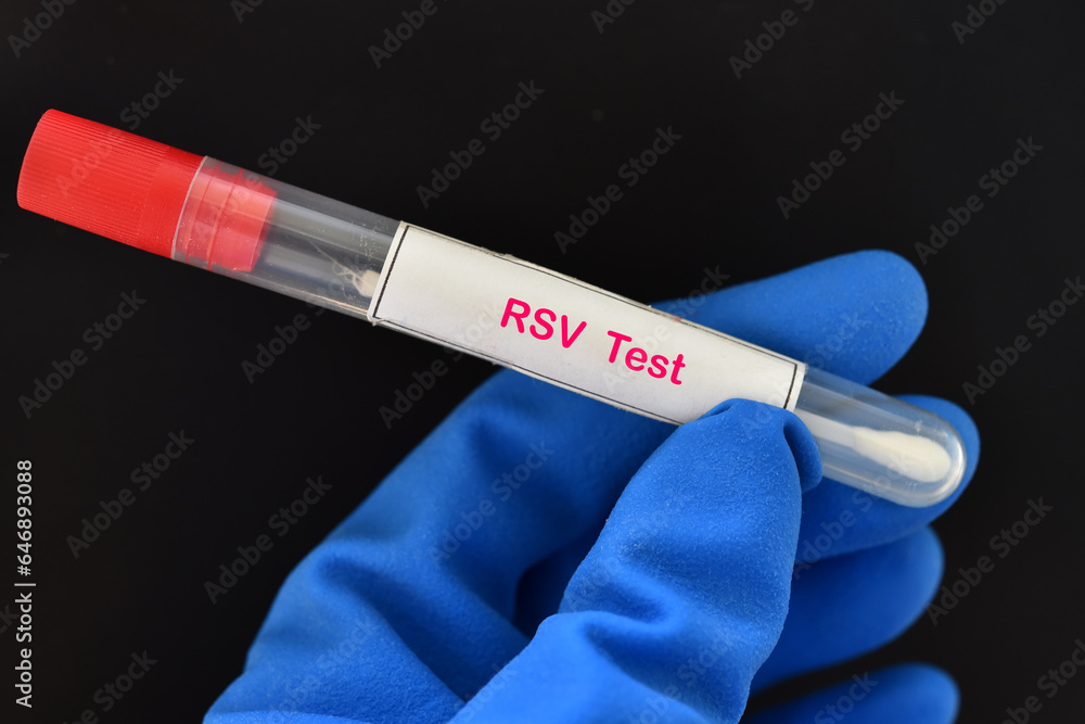 Nasopharyngeal swab from patient for respiratory syncytial virus (RSV