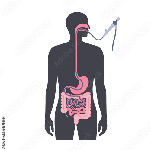 Balloon assisted enteroscopy