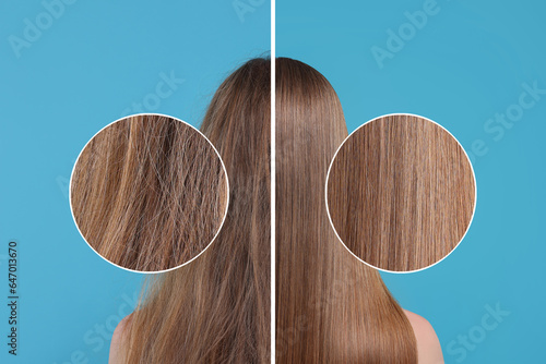 Photo of woman divided into halves before and after hair treatment on light blue background, back view. Zoomed area showing damaged and healthy strand