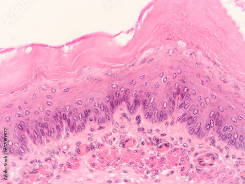 picture of histology human tissue with microscope from laboratory (not Illustration Designation)