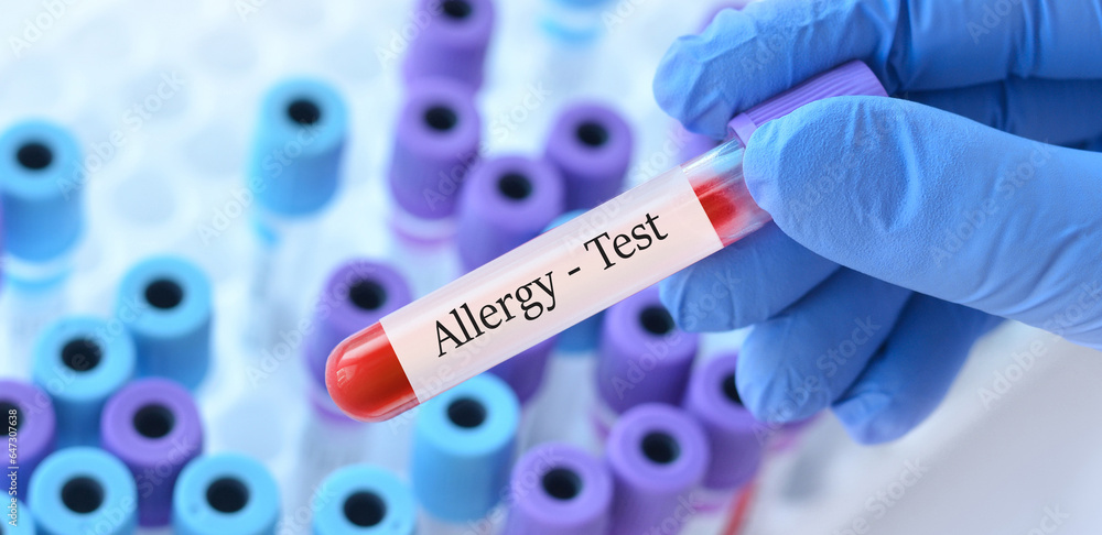 Naklejka premium Doctor holding a test blood sample tube with allergy test on the background of medical test tubes with analyzes