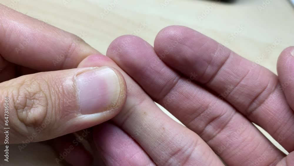 Male hand pressing on fingers to see if blood circulate well close up view. Health and well being concept Male hand pressing on fingers to see if blood circulate well close up view. Health and well being concept
