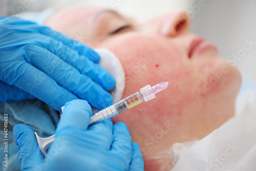 cosmetologist injects an injection of his own platelet-rich blood plasma under the patient's skin. Mesotherapy, biorevitalization.