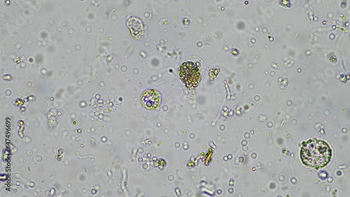 soil microorganisms close up under the microscope. in a soil samlple from a farm photo