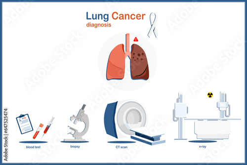 Human lung and white ribbon,Medical illustration vector concept of lung cancer Lung cancer diagnosis using blood tests,biopsy,CT scan,and X-ray.Illustration in flat style.isolated on white background.