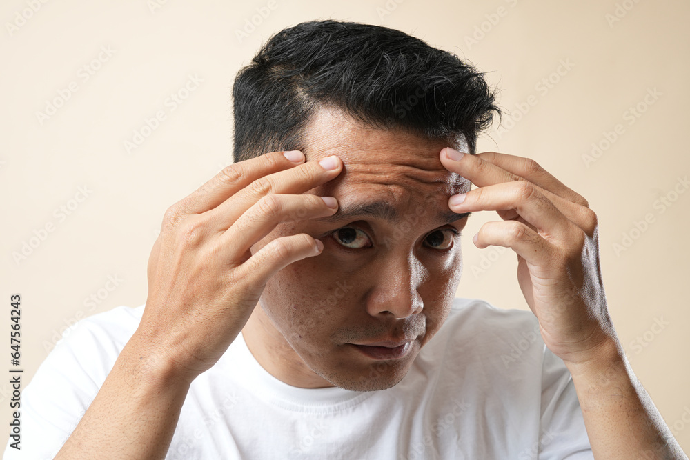 Fototapeta premium Photo of Asian man's face with wrinkles on the forehead. Collagen and face injections concept. Isolated on a beige background.
