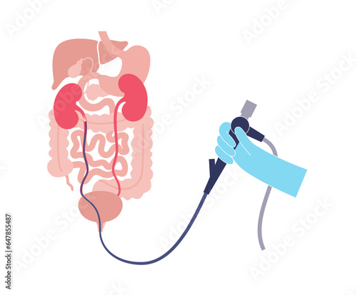 Ureteroscopy medical poster