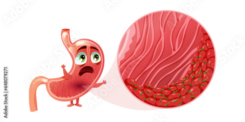 Scared cartoon stomach character with helicobacter pylori infection in epithelial cells under magnification