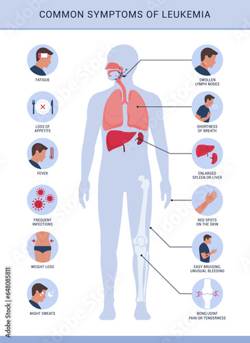 leukemia_symptoms_body_b