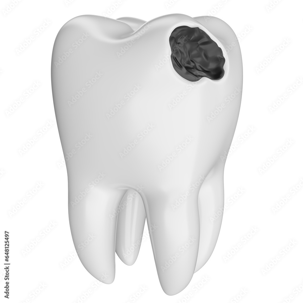 Realistic teeth with caries on transparent background in 3d rendering