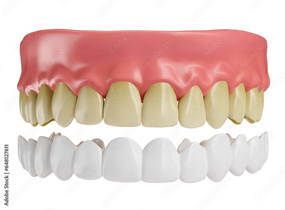 Obraz premium Realistic teeth with lenses and gums in on transparent background in 3d render 