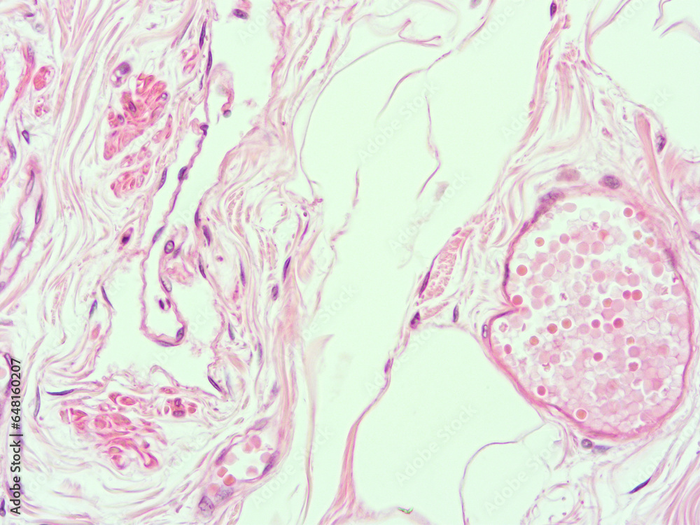 picture of histology human tissue with microscope from laboratory (not Illustration Designation)