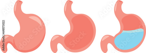 illustration of the stomach in different states. Cartoon visual illustration showing what the stomach looks like 