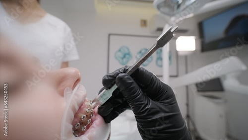 Close up of dentist hand using dental forceps while putting orthodontic braces on female patient teeth. Woman having dental procedure in clinic. Concept of dentistry and orthodontic treatment. photo