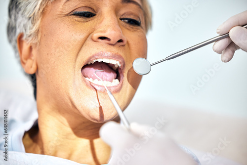 Senior woman, mouth and dentist check teeth, metal tools and hands with healthcare, toothache and dental surgery. Cleaning, wellness and health with oral care procedure, equipment and help with trust