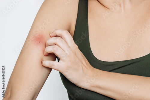Принти на полотні Cropped shot of a young woman scratching an insect bite on her arm