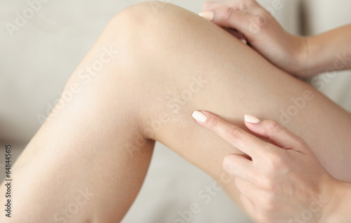 Fototapeta Naklejka Na Ścianę i Meble -  Light scar on skin on woman leg. Skin restoration in case of scars and wounds concept