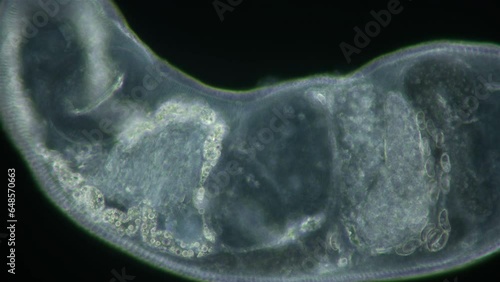 Parasitic Trematoda worm under microscope, possibly Brachyphallus crenatus. Stage of development of mature larva is Metacercaria. White sea photo