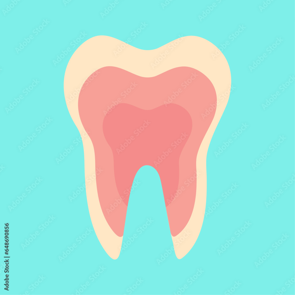 Inflamed tooth, inflamed pulp Inflamed tooth, inflamed pulp